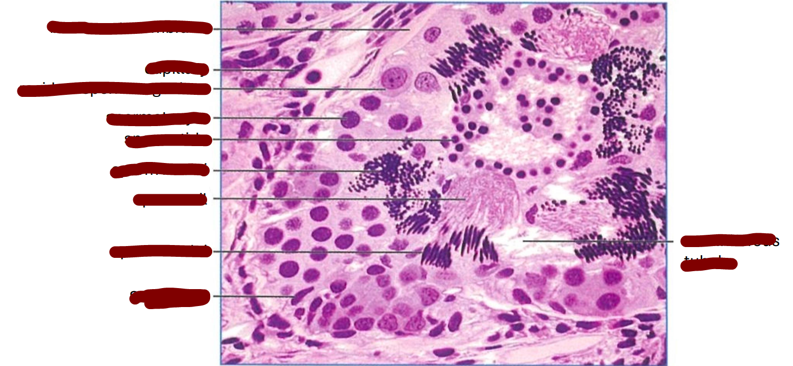 <p>transverse section through part of a frog seminiferous tubule </p>