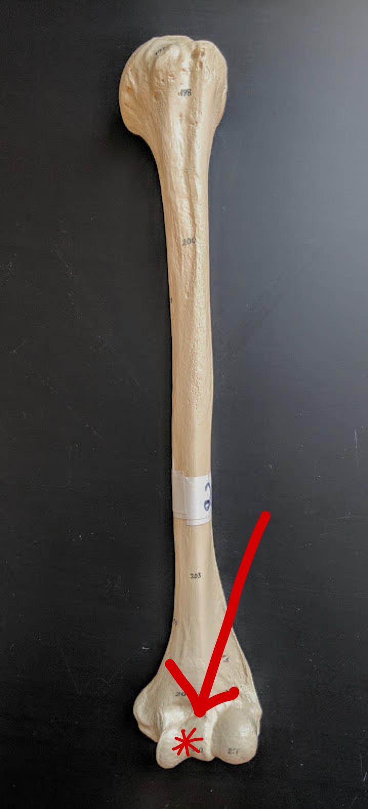 <p>Name this structure</p>