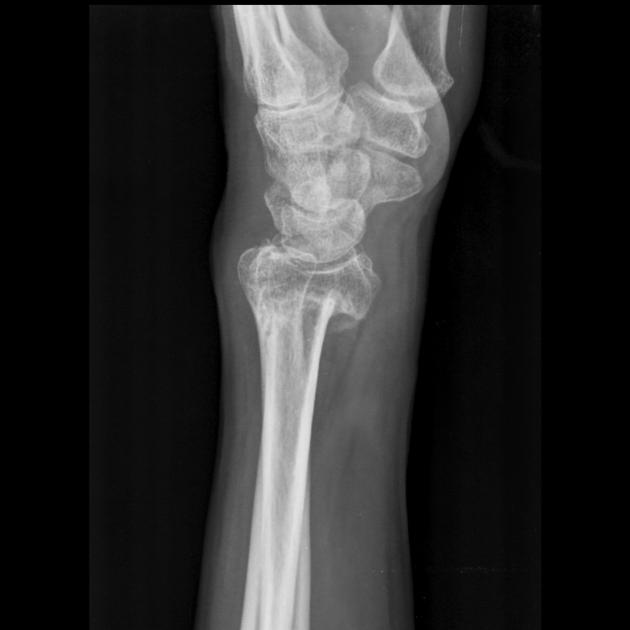 <p>Describe the abnormality demonstrated.</p>