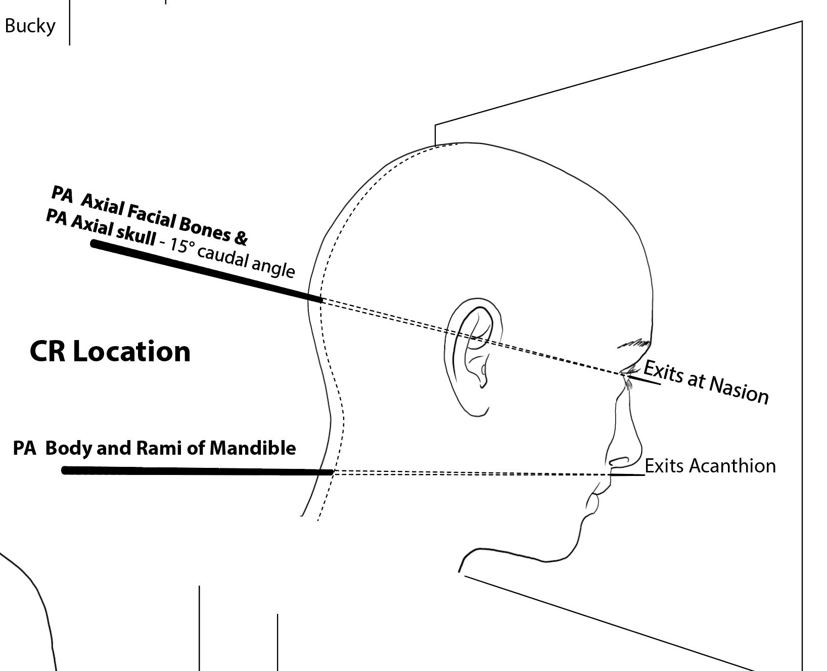 <p>15°&nbsp;caudal exits nasion</p><p>OML 15° cephalic , exits nasion</p>