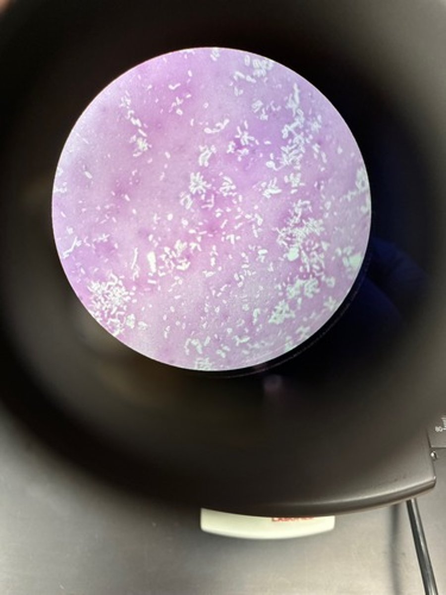 <p>What stain is this?</p>