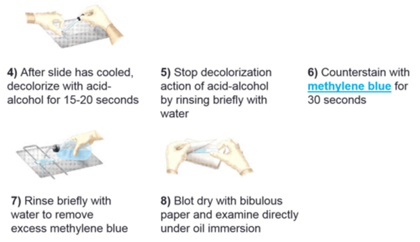 <p>This procedure is for the</p>