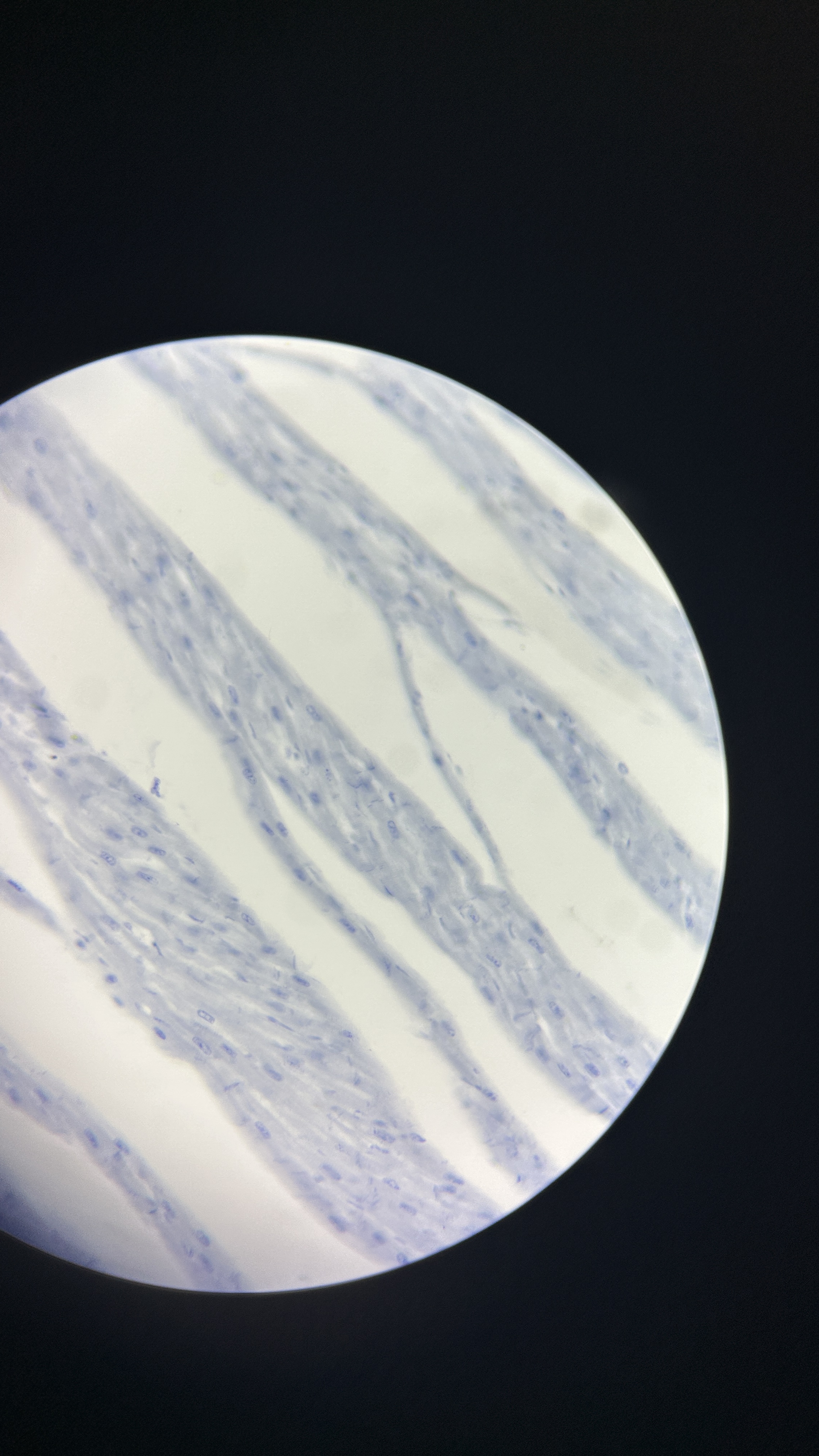 <p>What is the magnification level of the Cardiac Muscle?</p>