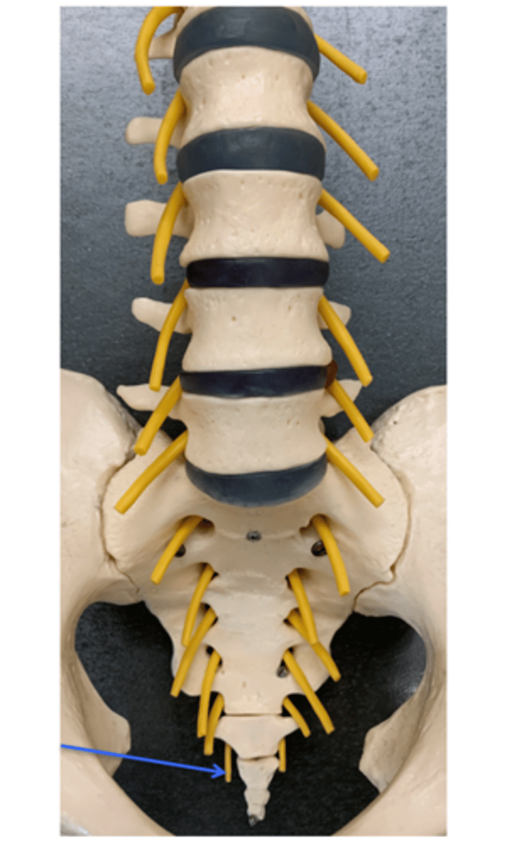 <p>Name this Spinal Nerve</p>
