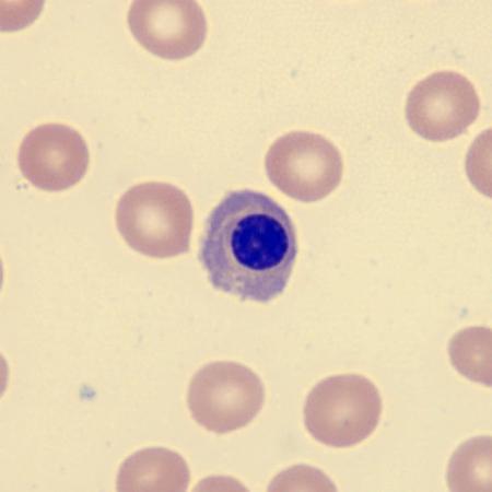 <p>What is this erythrocyte?</p>