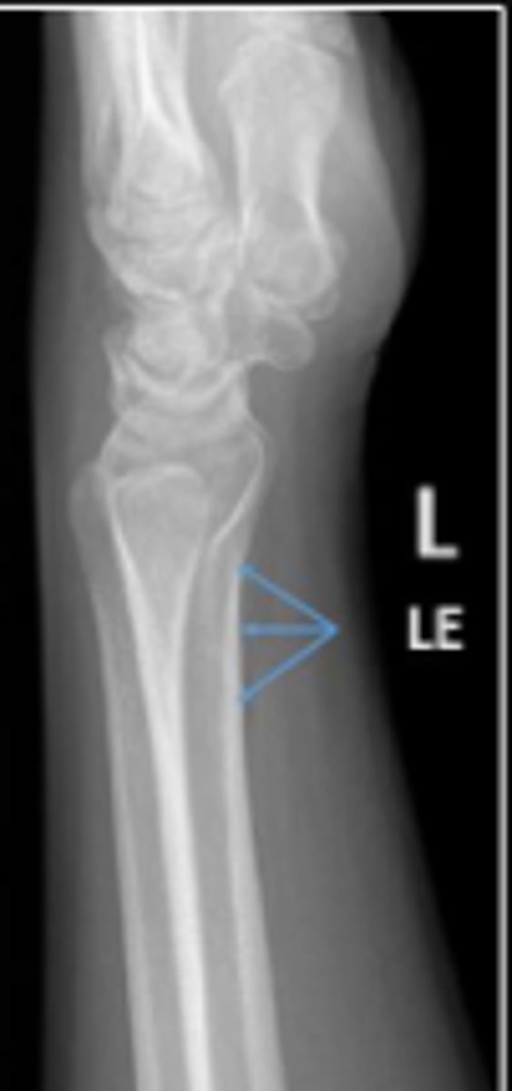 <p>What is the arrow pointing to?</p>