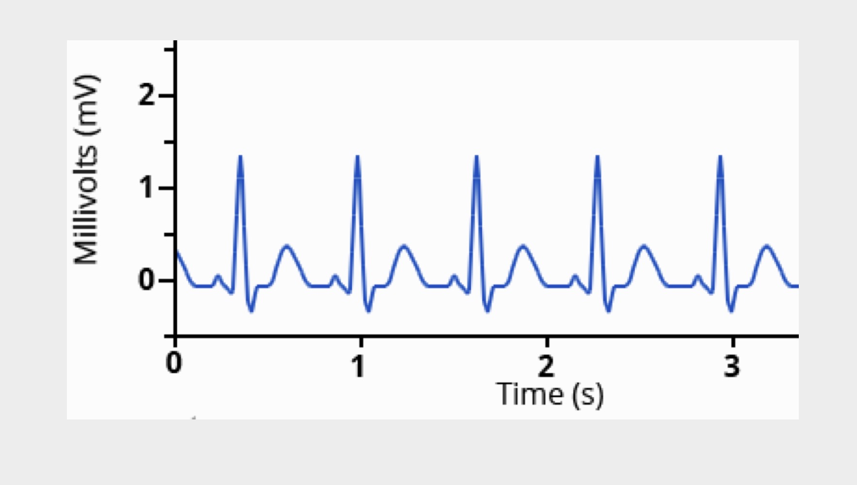 <p>Less time between QRS complexes</p>