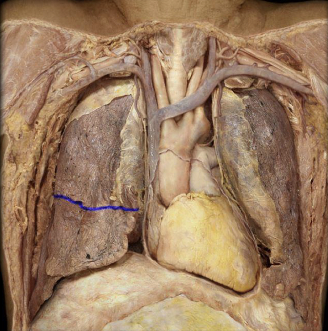 What structure is highlighted in blue?