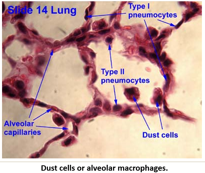 <ul><li><p><strong>Monocyte-derived cells</strong> that <strong>phagocytize debris</strong>.</p></li><li><p>Move up the <strong>mucociliary escalator</strong>.</p></li></ul><p></p>
