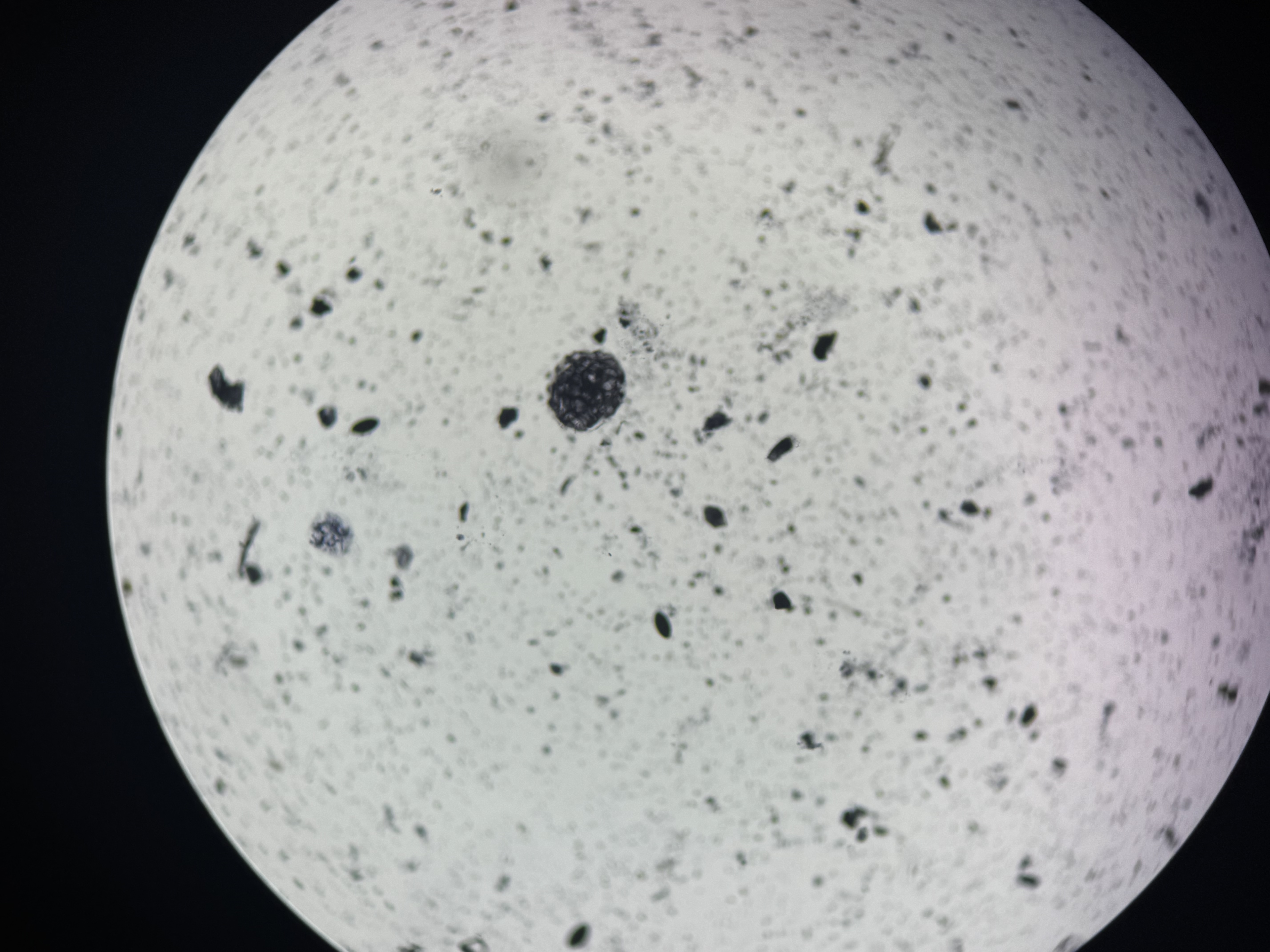 <p>Entamoeba histolytica</p>