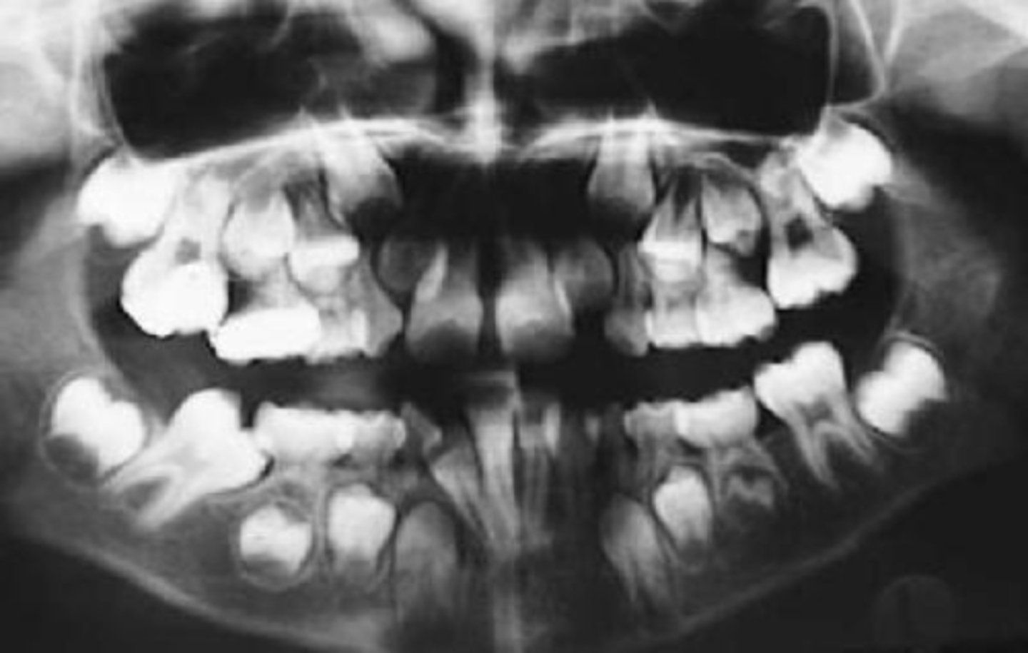 <p>ID the developmental disturbance:</p>