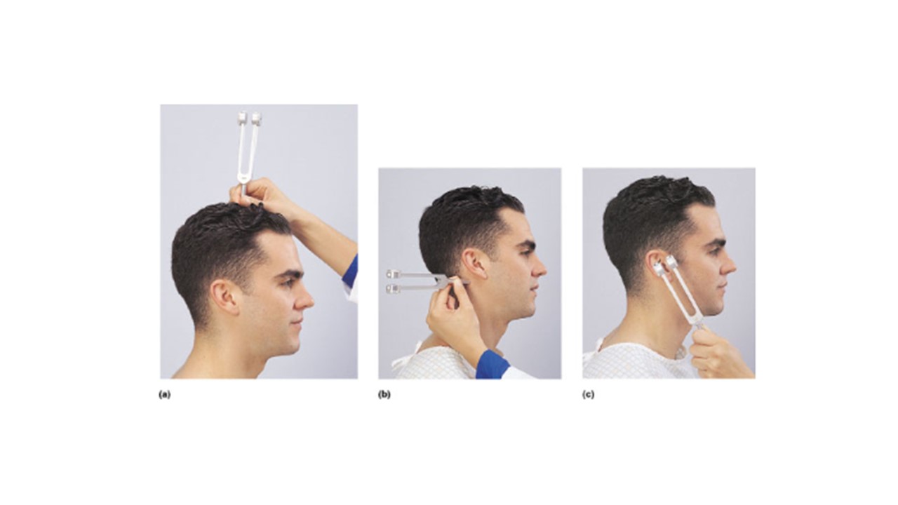 <p><span>Which lettered image(s) above demonstrates the proper administration of the Weber Test?</span></p>