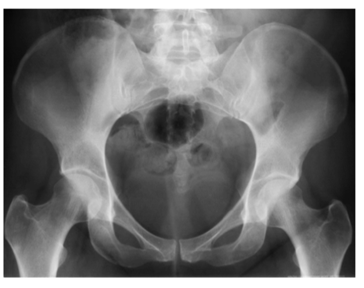 <p>NARROWER (thinner)</p>