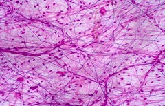 Type: loose 

Location: under epithelial membrane, surrounding blood vessels

Function: connect muscle fibers & surround blood and lymph vessels