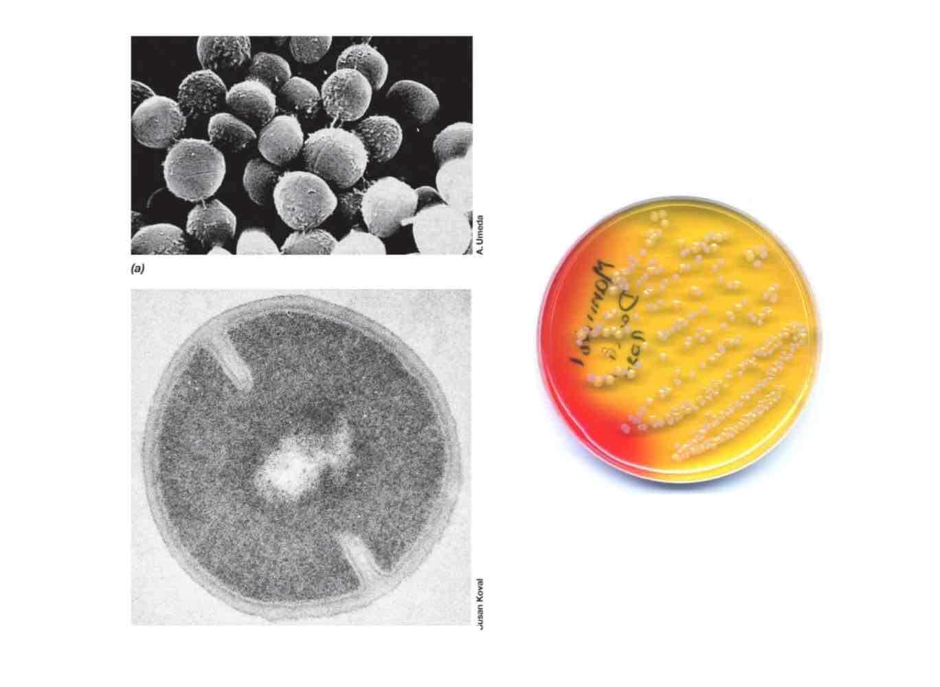 <p><em>Staphylococcus aureus</em> is a halotolerant, facultative anaerobe forming grape-like clusters, living on skin, frequently causing wound infections in surgery, i.e. nosocomial infections.</p>