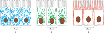 <p>(Q005) Which of the following represents the placement of microtubules in an epithelial cell?</p>