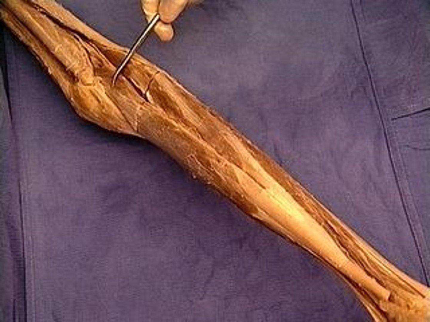 <p>the muscle in the back part of the leg that forms the greater part of the calf</p>