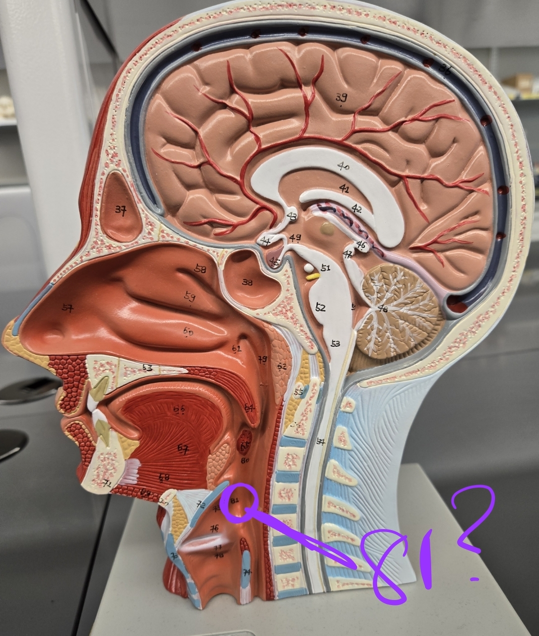 <p>Half head model: what structure is this?</p>