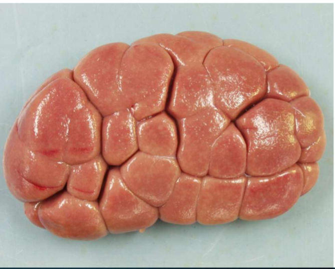 <ol><li><p><strong>Species/specimen- </strong>bovine kidney</p></li><li><p><strong>Compulsory inspection of this specimen- </strong>Visual inspection</p></li><li><p><strong>Describe using 3 words- </strong>diffuse, raised, indentations, few little white spots</p></li><li><p><strong>Potential diagnosis</strong></p><ol><li><p>Interstitial nephritis- local rejection unless uremeia (tinted coloration and funky smell)</p><ol><li><p>results of a viral infection</p></li><li><p>white and spotted in acute cases</p></li><li><p>all ages male and female</p></li></ol></li></ol></li><li><p><strong>Judgement- </strong>local rejection, if uremia then total rejection</p><ol><li><p>Category 2</p></li></ol></li></ol><p></p>