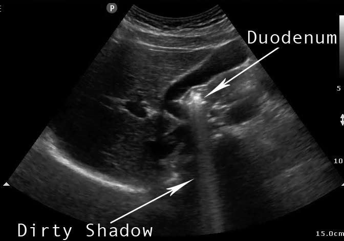 <p>Dirty Shadow</p>