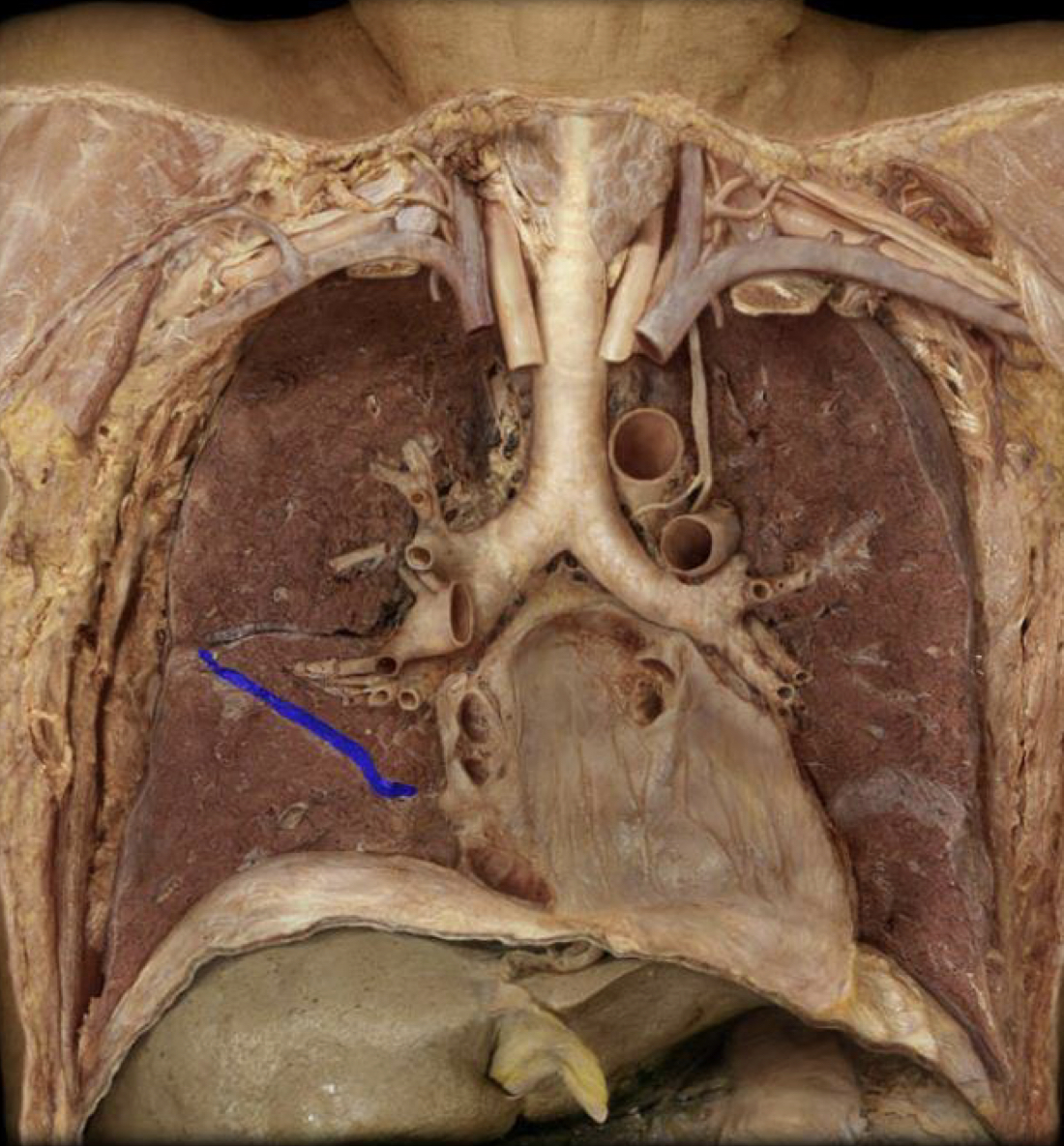 What structure is highlighted in blue?