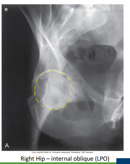 <p>Internal oblique.</p>