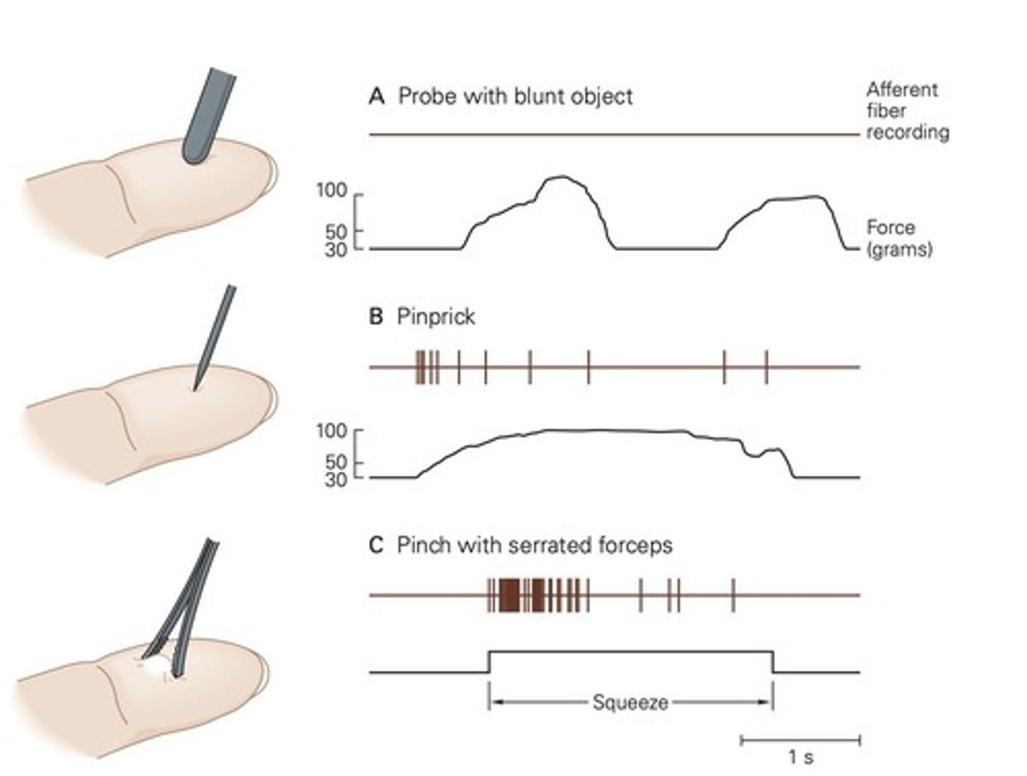 <p>It refers to the ability to distinguish between relevant stimuli (pain) and irrelevant stimuli.</p>