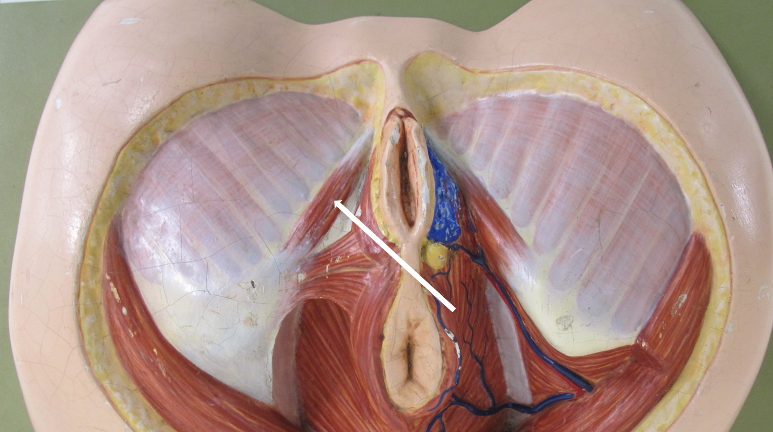 <p>spier van vrouwelijk perineum</p>