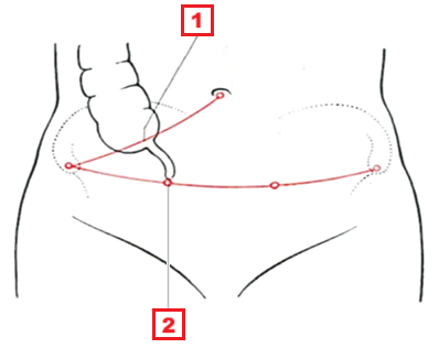 <p>1 (latijns)</p>
