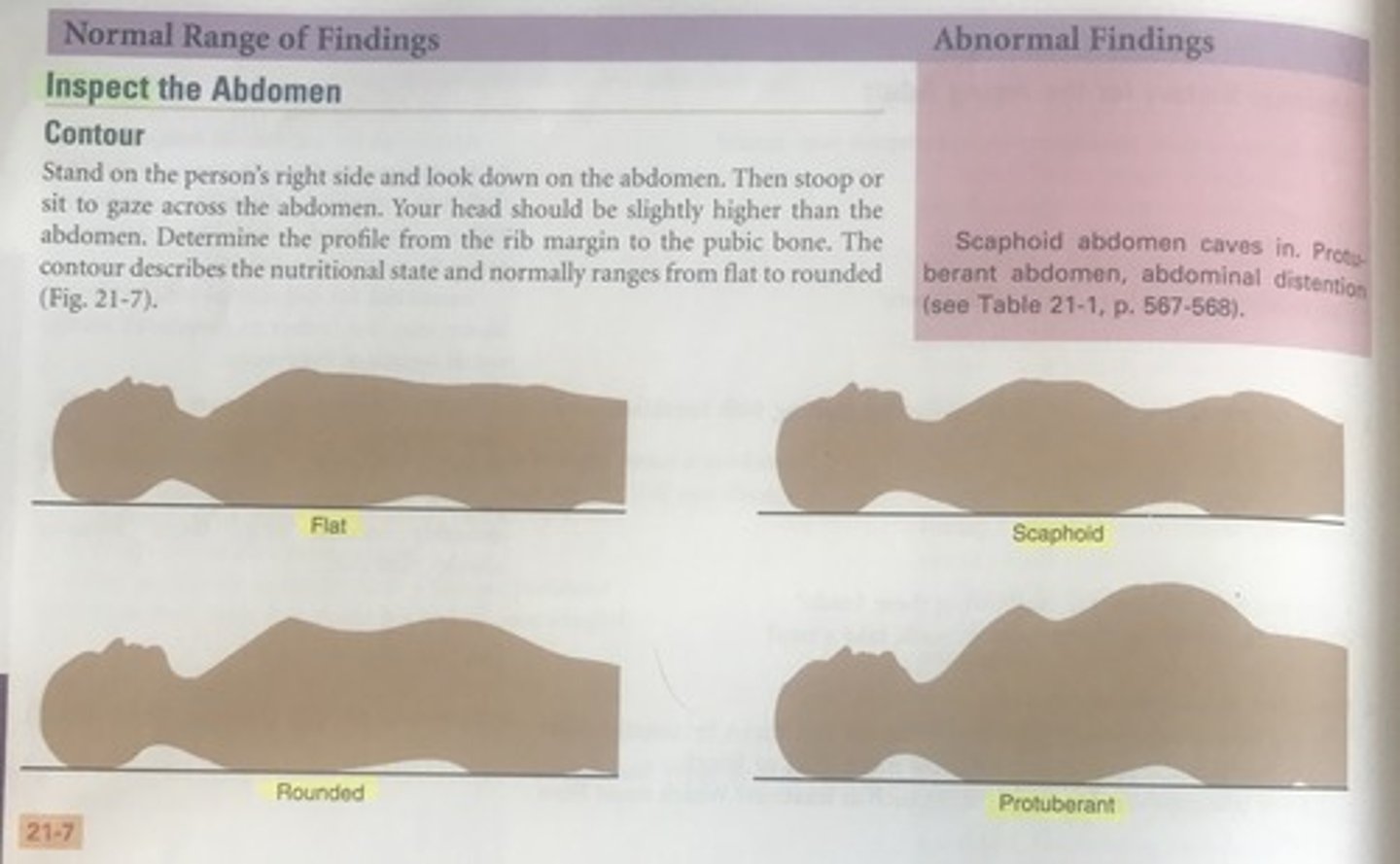 <p>D</p><p>Contour describes the profile of the abdomen from the rib margin to the pubic bone; a scaphoid contour is one that is concave from a horizontal plane (see Figure 21-7).</p>