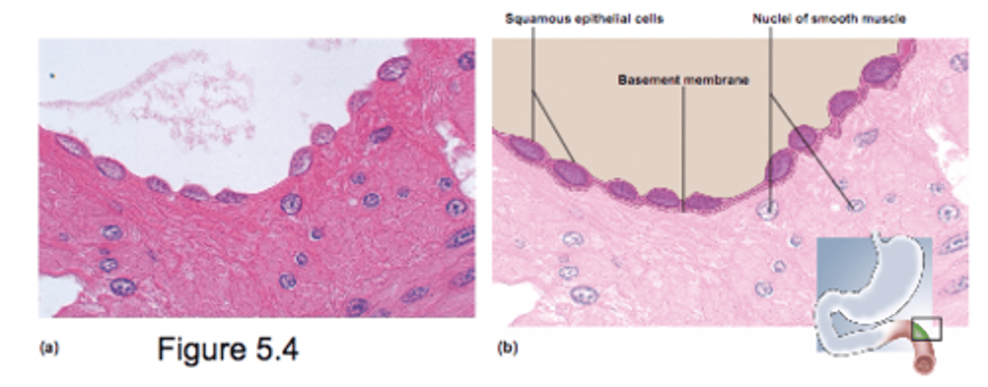 <p>- Single layer of thin cells</p><p>- permits rapid diffusion of substances</p><p>- poor protection</p>