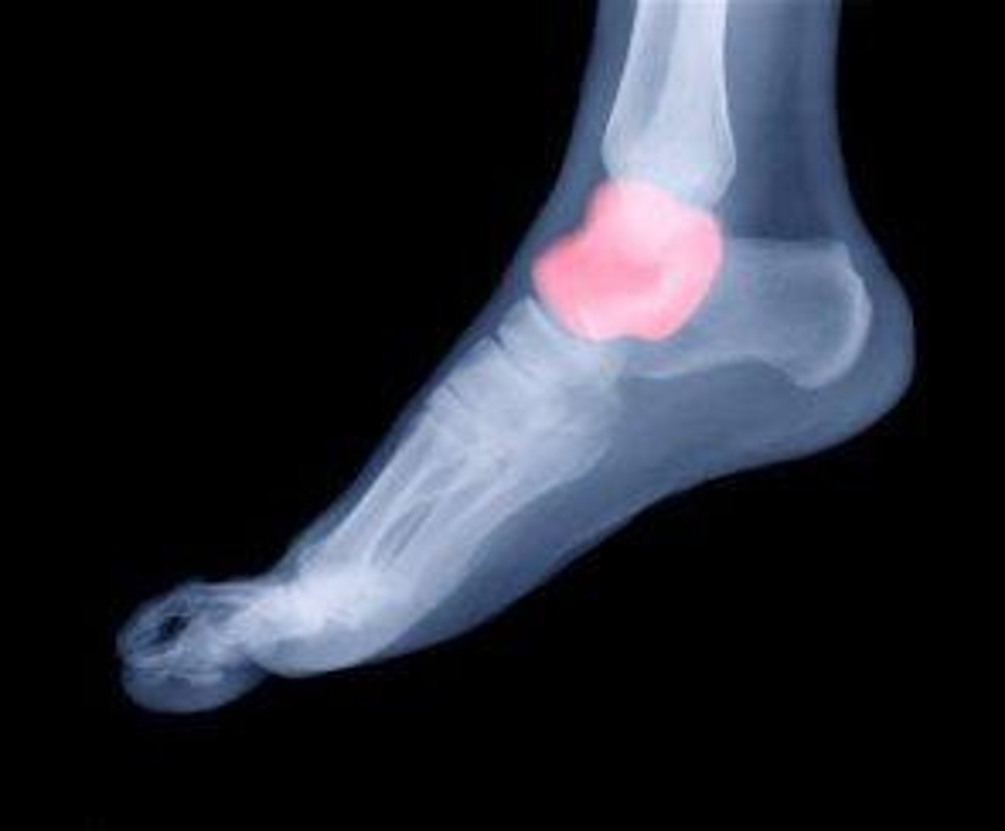 <p>What is the term of the bones highlighted in pink?</p>