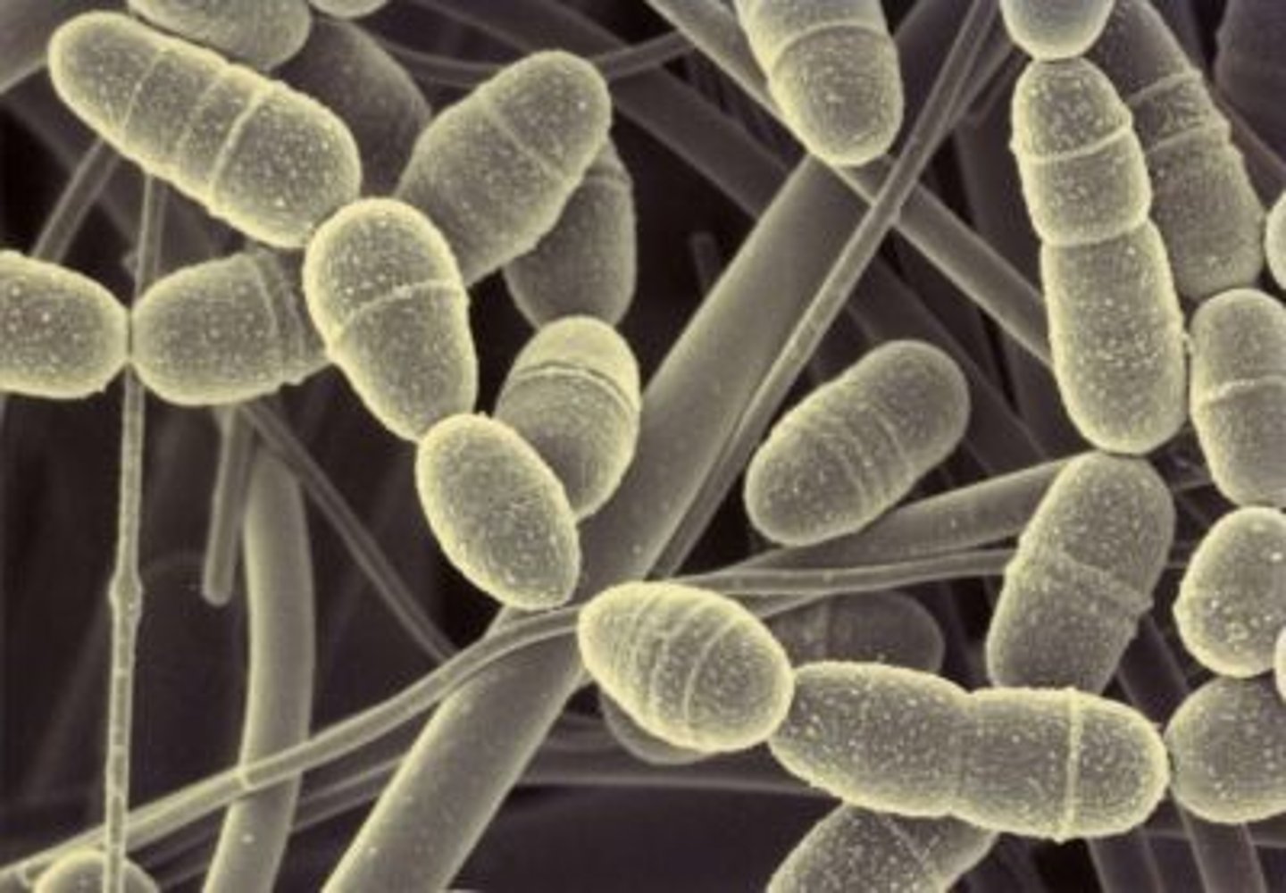 <p>Caused by gram-positive streptococcus mutans and lactobacillus, happens when sugars react with the bacteria on the dental biofilm, fillings and pulp capping and root canals, prevention it to maintain good oral hygiene.</p>