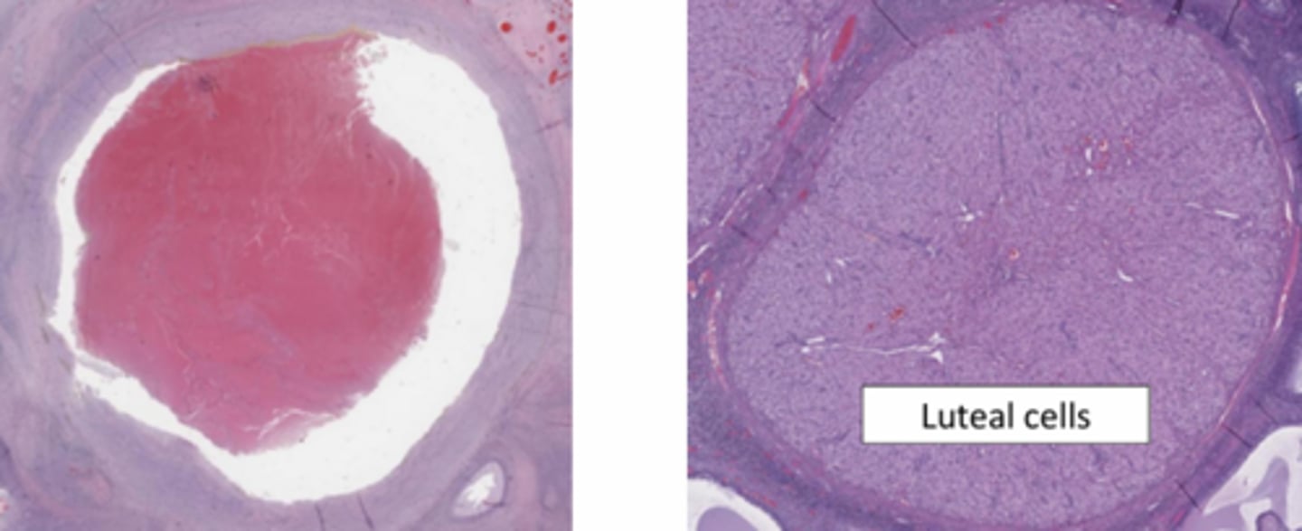 <p>what collapses into the ruptured follicle (corpus hemorrhagicum) and gets hypertrophied and has hyperplasia?</p>