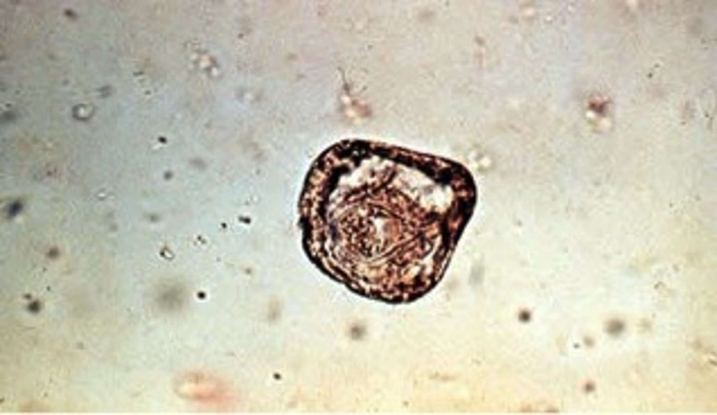 <p>The egg of this parasite is quadrilateral in shape.</p>