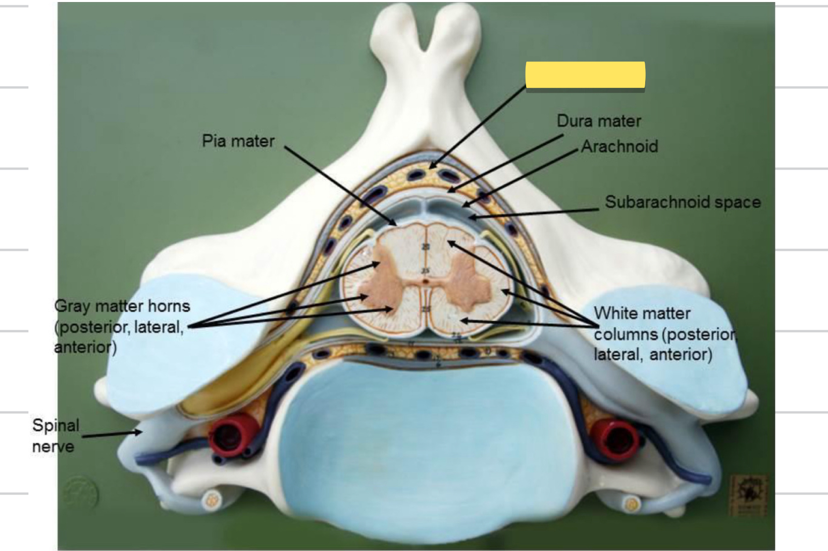<p>Name this spinal cord part</p>
