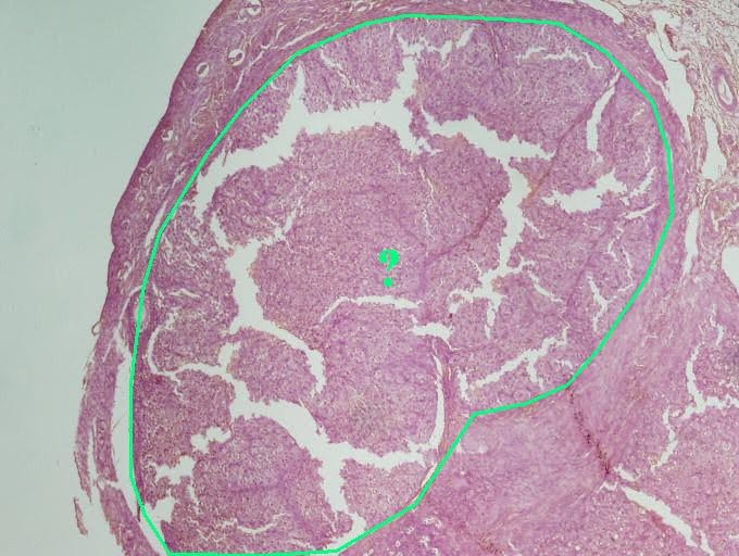 <p><span><span>Identify the indicated structure within the ovary.</span></span></p>