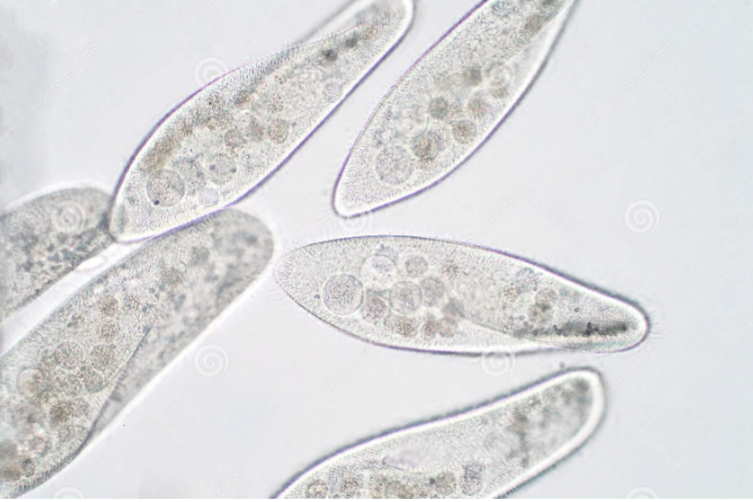 * Largest unicellular organism
* Phylum: Ciliophora
* Heterotrophic (cannot prepare their own food and depend upon autotrophs for nutrition)
* Move using cilia 
* most complex protozoan
