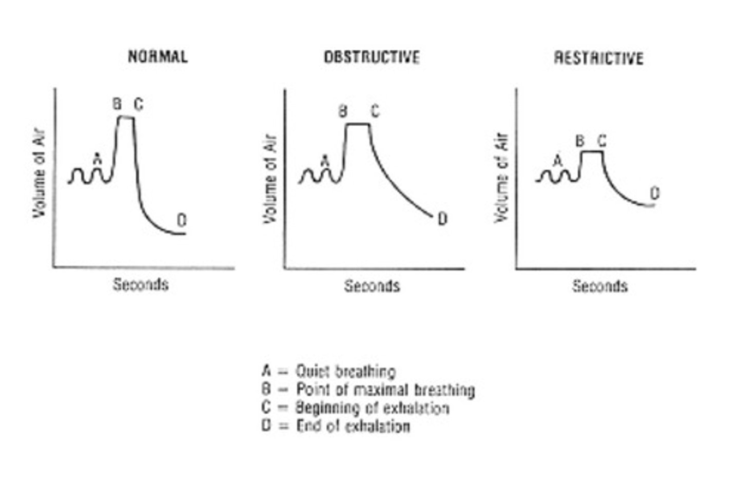 <p>obstructive: FEV1/FVC &lt; 70%</p><p>restrictive: volumes are decreased (TLC, FRC, and RV); they may have normal VC and FEV1/FVC</p>
