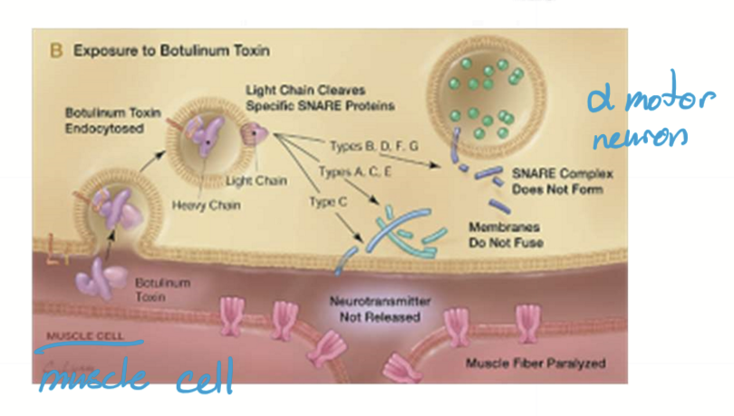 <p>Botulism is a toxin released by Clostridium botulinum that causes flaccid paralysis by inhibiting SNAREs of lower motor neuron in NMJ (no ACh released) </p>