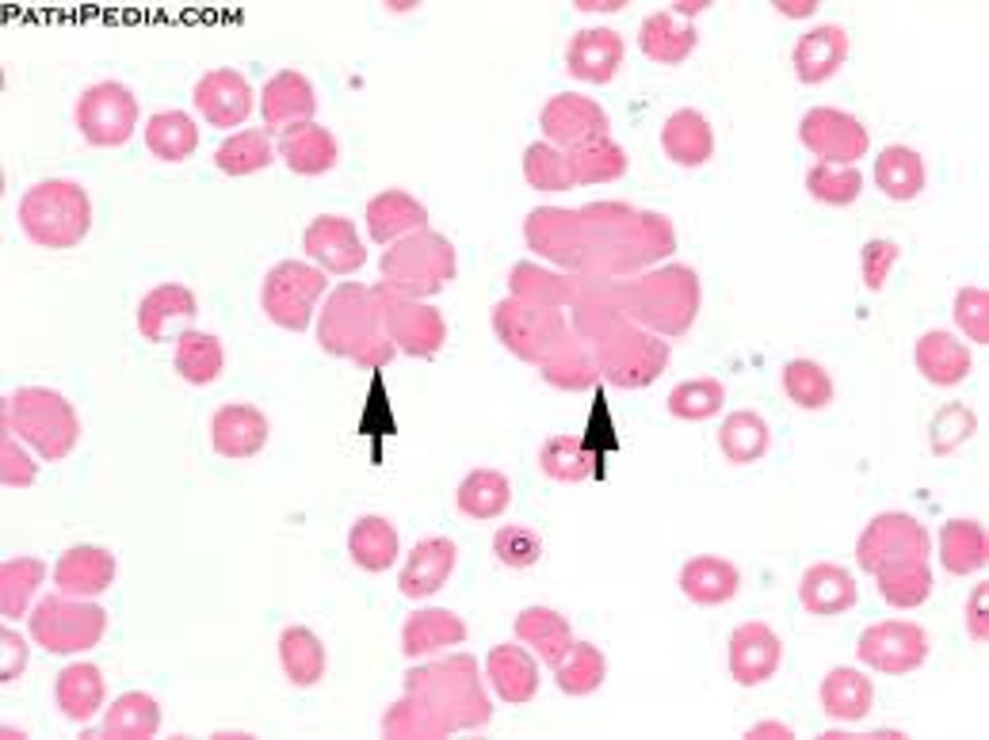 <p>clumping of blood</p>