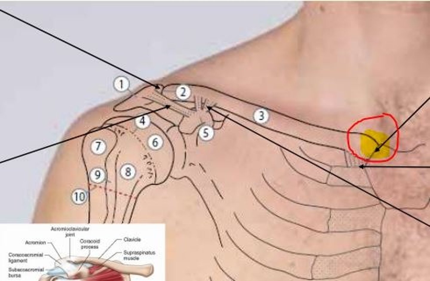 <p>Sternoclavicular joint</p><p>- Only joint between the upper limb and axial skeleton</p><p>- Supported by the costoclavicular ligaments</p>