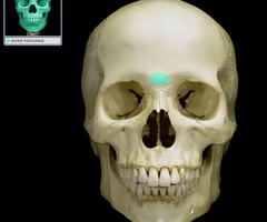 <p>Smooth area between the eyes</p>