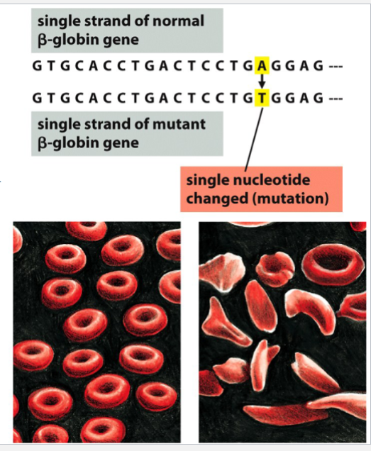 <p>an example of a consequence of a point mutation in the beta-globin gene</p><p>a single nucleotide substitution occurs in DNA (A→T) → causes an amino acid change</p><p>the changed amino acid alters the tertiary structure of beta-globin</p><p>blood cells are deformed (sickled) and function/efficiency is inhibited</p>