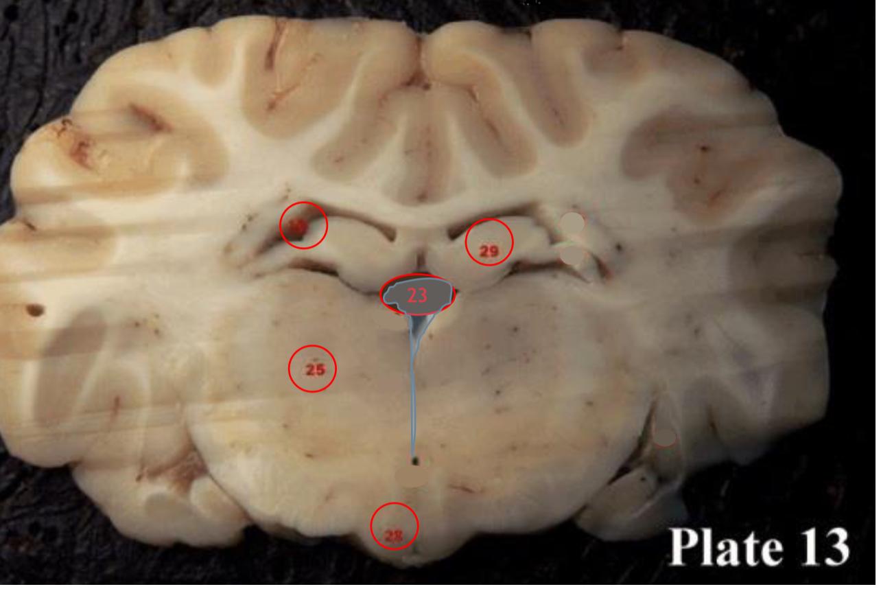 <p><span>hippocampus</span></p>
