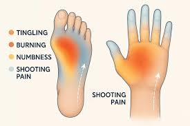 <p>Peripheral Neuropathy</p>
