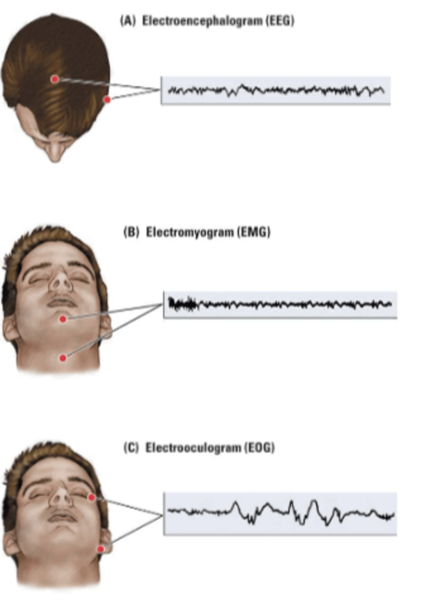 <p>-Electroencephalogram (EEG)</p><p>*Brain-wave activity</p><p>-Electromyogram (EMG)</p><p>*Muscle activity</p><p>-Electrooculogram (EOG)</p><p>*Eye movement</p>