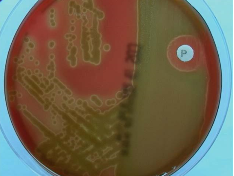 <p>What is the use of this test</p><p>What is the antibiotic disk?</p><p>What is the hemolysis activity?</p>