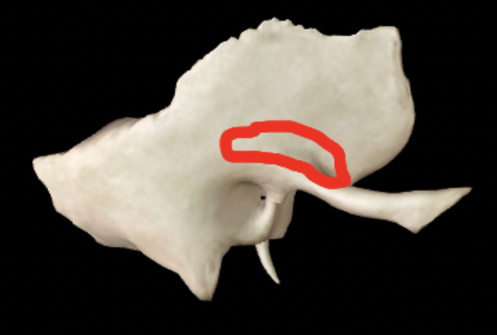 <p>What part of the temporal bone is this?</p>