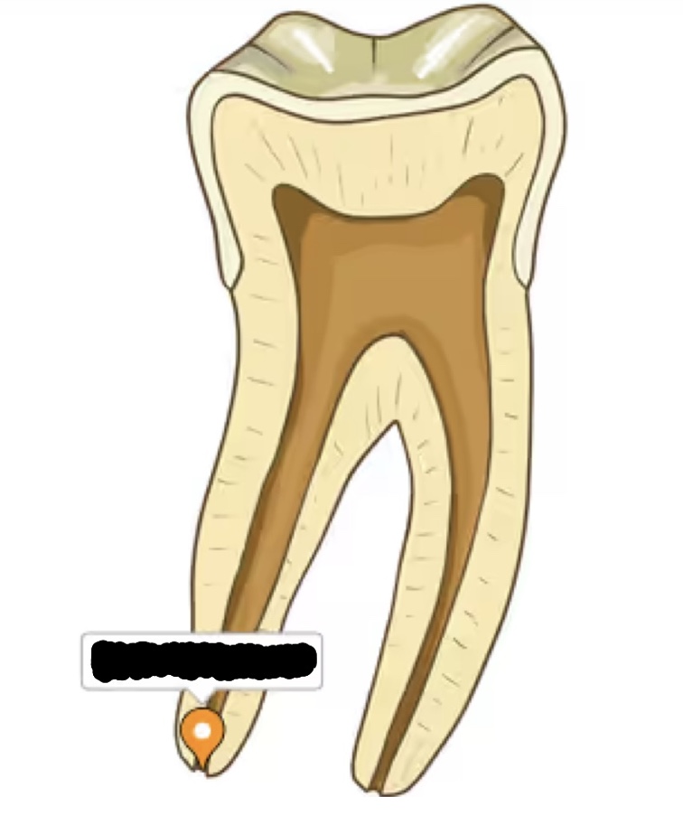 <p>opening at tooth’s root where nerves and blood vessels enter</p>
